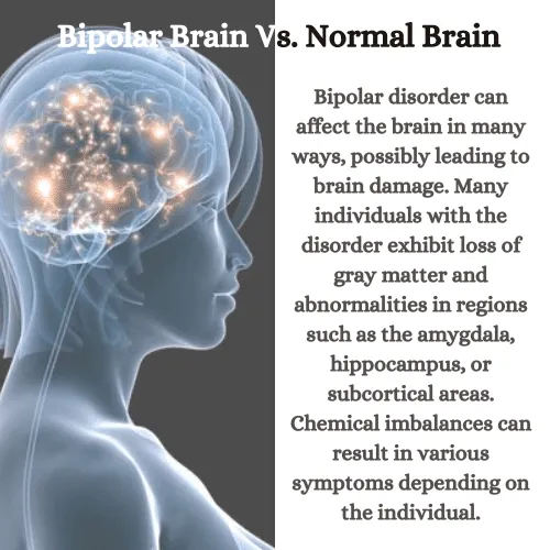 Bipolar Brain Vs. Normal Brain