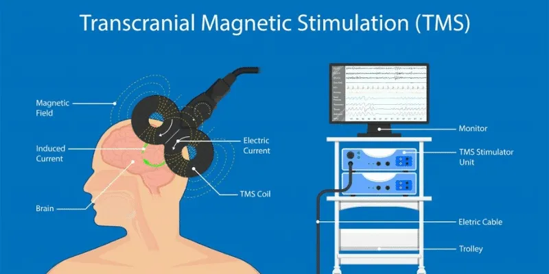 TMS Diagram